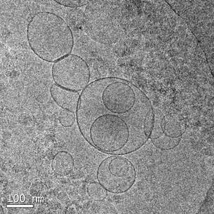 Vesícules extracel·lulars (Investigació > Línies de recerca) | iCor | Institut del Cor del germans Trias i Pujol