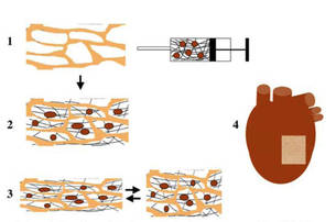 Artificial scaffolds (Research > Research lines > Tissue Engineering) | iCor | Institut del Cor del germans Trias i Pujol